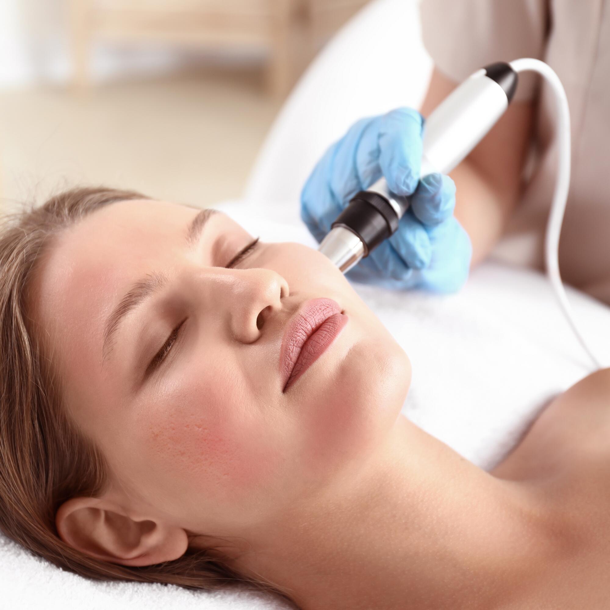 Dermatologisk laserbehandling for å redusere aknearr i ansiktet